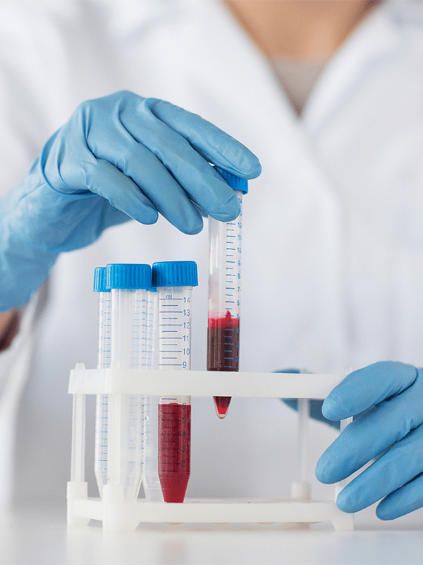 Lab technician arranging blood samples for the Comprehensive Screening Panel.